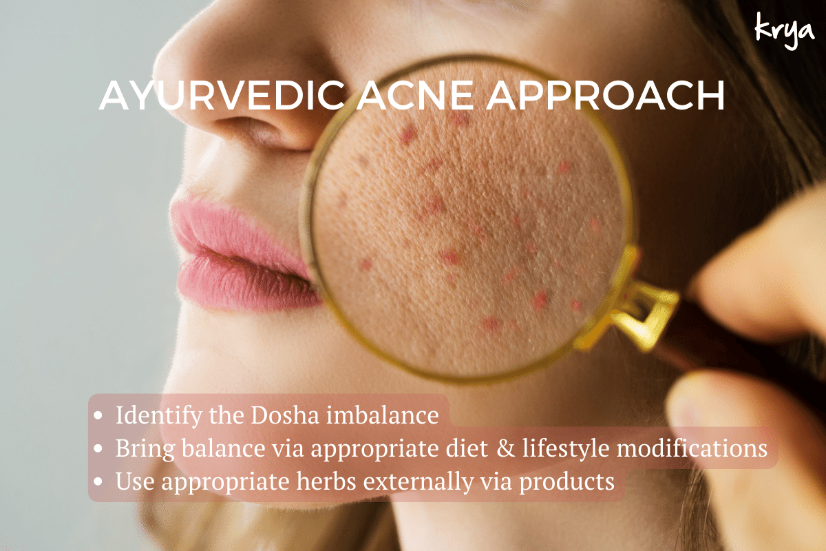 The Ayurvedic approach to treating acne