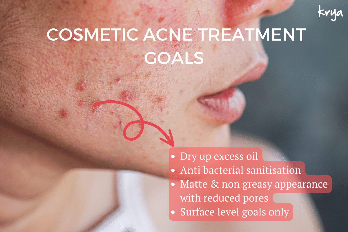 goals of cosmetic industry while treating acne