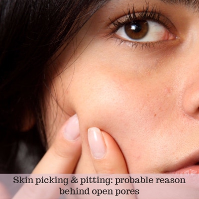 Open pores: possible reason is picking of acne 