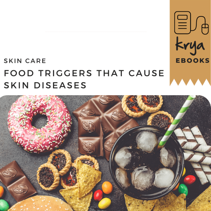 Food triggers that cause skin disease - free krya ebook