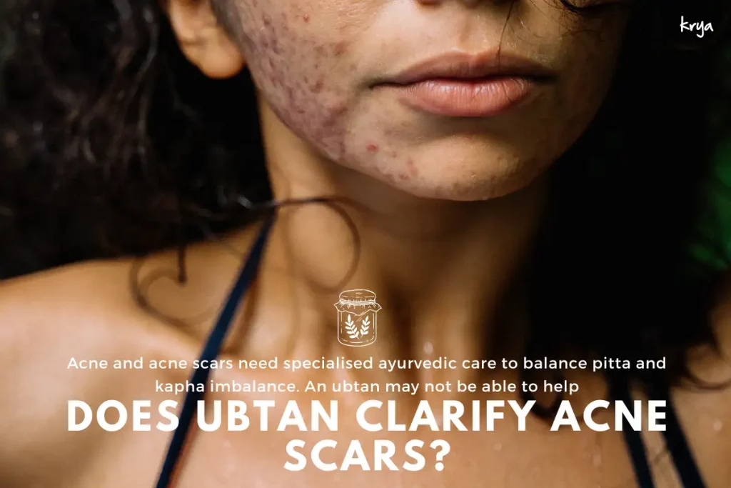 An ubtan may not be very effective for reducing acne or clarifying acne scars. 